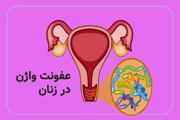 علت‌ اصلی عفونت‌ زنان