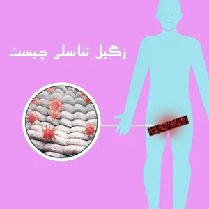 درمان زگیل تناسلی - درمان تضمینی