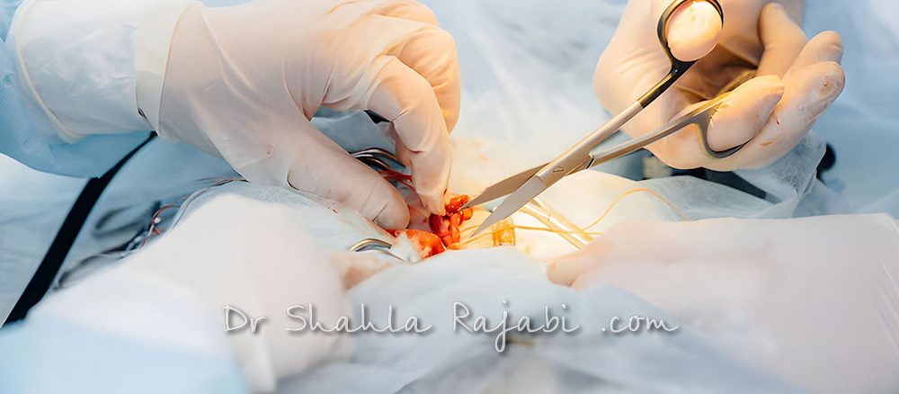 بهترین دکتر عمل زیبایی واژن